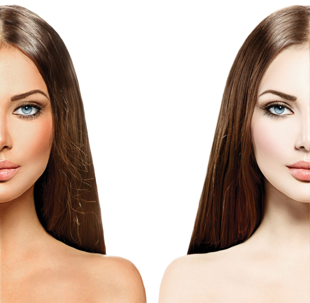 Spray-Tanning Frau vorher/nachher